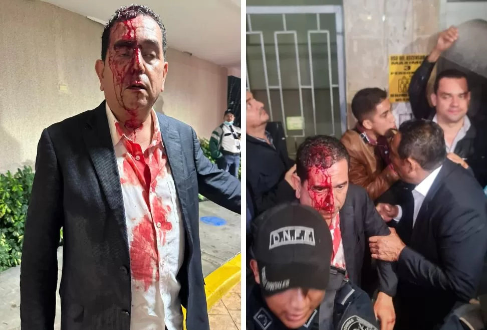 El Congreso Nacional fue testigo de un acto de violencia que dejó al diputado del Partido Nacional, Antonio Rivera Callejas, con dolor de cabeza y una experiencia aterradora. Rivera Callejas fue agredido por colectivos del partido Libre durante. El saldo: siete puntos en su cabeza.