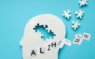 Postergan aprobación de un fármaco contra el Alzheimer