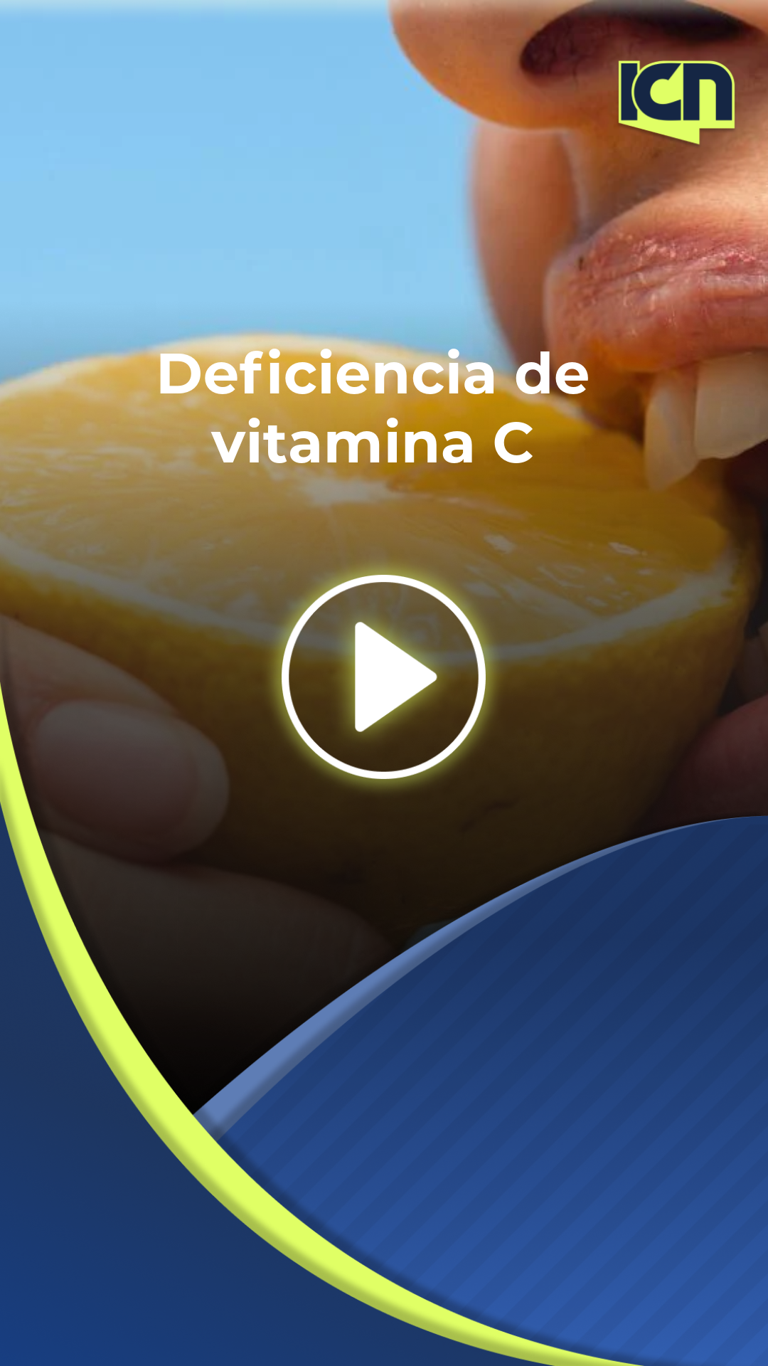 Nueve síntomas de deficiencia de vitamina C